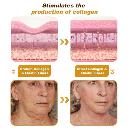 Botox Bee Venom Wrinkle Repair Cream