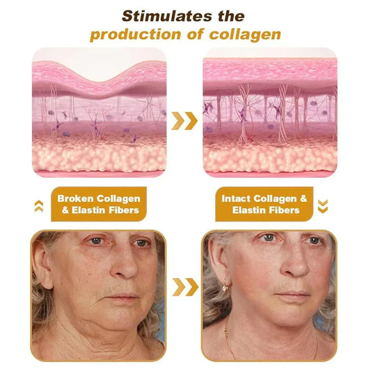 Botox Bee Venom Wrinkle Remover Cream (Buy 1 Get 1 Free)