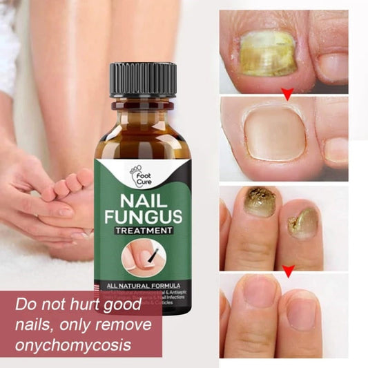 Fast Nail Fungal Serum