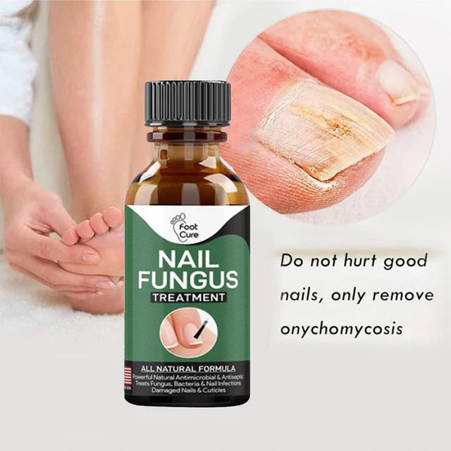 Fast Nail Fungal Treatment